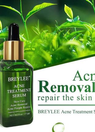 Acne Treatment Serum Facial Repair Oil